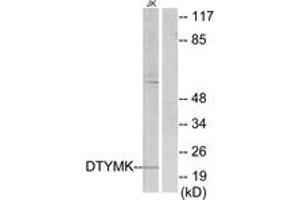 Western Blotting (WB) image for anti-Deoxythymidylate Kinase (Thymidylate Kinase) (DTYMK) (AA 1-50) antibody (ABIN2889430) (DTYMK antibody  (AA 1-50))