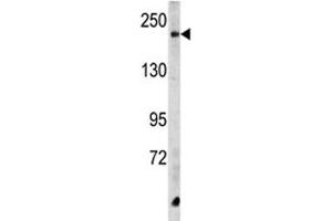 Western blot analysis of CPD antibody and HeLa lysate. (CPD antibody  (AA 1019-1048))