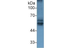 Detection of BACE2 in Rat Spleen lysate using Polyclonal Antibody to Beta Secretase 2 (BACE2)