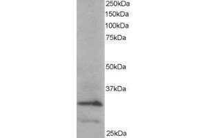 Western Blotting (WB) image for Actin Related Protein 2/3 Complex, Subunit 2, 34kDa (ARPC2) peptide (ABIN370297)