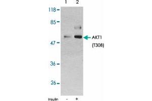 Western blot analysis of extracts from 293Tcells untreated or treated with insulin using AKT1 (phospho T308) polyclonal antibody . (AKT1 antibody  (pThr308))