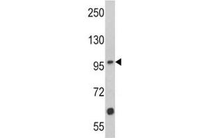 Western Blotting (WB) image for anti-Muscle, Skeletal, Receptor Tyrosine Kinase (MUSK) (AA 35-65) antibody (ABIN3031877)