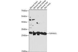 Western blot analysis of extracts of various cell lines, using TSP antibody (ABIN7270789) at 1:3000 dilution. (TSPAN31 antibody  (AA 95-175))