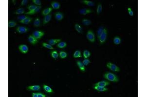 Immunofluorescent analysis of HepG2 cells using ABIN7174852 at dilution of 1:100 and Alexa Fluor 488-congugated AffiniPure Goat Anti-Rabbit IgG(H+L) (C4ORF3 antibody  (AA 1-44))