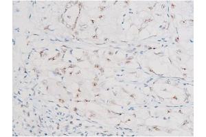 Immunohistochemistry (IHC) image for anti-Nuclear Factor-kB p65 (NFkBP65) (pSer281) antibody (ABIN6255162)