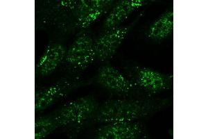 Immunofluorescence (IF) image for anti-Sorting Nexin 1 (SNX1) antibody (ABIN5877304) (Sorting Nexin 1 antibody)