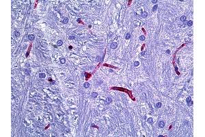 Anti-RECA-1 antibody IHC of rat brain, cerebellum vessels. (RECA-1 antibody)