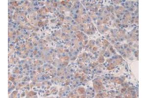 IHC-P analysis of Human Pancreas Tissue, with DAB staining. (Kallikrein 6 antibody  (AA 17-244))