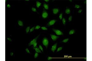 Immunofluorescence of monoclonal antibody to ATP2C1 on HeLa cell.