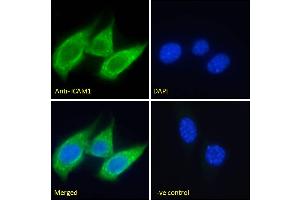 ABIN5539625 Immunofluorescence analysis of paraformaldehyde fixed NIH3T3 cells, permeabilized with 0. (ICAM1 antibody  (Internal Region))