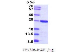 SDS-PAGE (SDS) image for Tumor Protein, Translationally-Controlled 1 (TPT1) (AA 1-172) protein (His tag) (ABIN5854238)