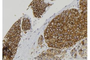 ABIN6277899 at 1/100 staining Human pancreas tissue by IHC-P. (Amylin/DAP antibody  (Internal Region))