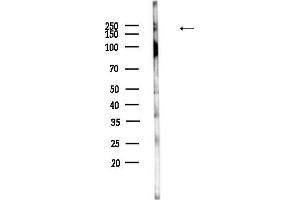 anti-PRP8 Pre-mRNA Processing Factor 8 (PRPF8) (C-Term) antibody