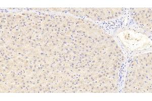 Detection of PCNT in Human Liver Tissue using Polyclonal Antibody to Pericentrin (PCNT) (PCNT antibody  (AA 2987-3246))