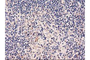 Image no. 7 for anti-Prenyl (Decaprenyl) Diphosphate Synthase, Subunit 2 (PDSS2) antibody (ABIN1500138) (PDSS2 antibody)