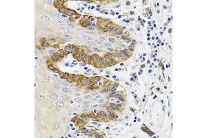 Immunohistochemistry of paraffin-embedded Human trachea using ESD antibody (ABIN1882355) at dilution of 1:100 (40x lens).