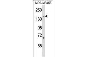 Western blot analysis in MDA-MB453 cell line lysates (35ug/lane). (ARHGEF11 antibody  (AA 605-632))