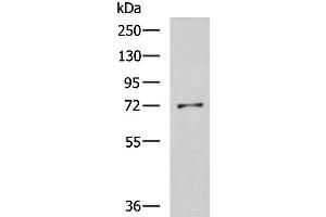 Western blot analysis of K562 cell lysate using GSTCD Polyclonal Antibody at dilution of 1:800 (GSTCD antibody)