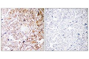 Immunohistochemistry analysis of paraffin-embedded human placenta tissue, using CCDC102B antibody. (CCDC102B antibody  (Internal Region))