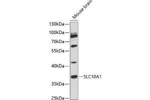 Western blot analysis of extracts of mouse brain, using SLC10 antibody (2721) at 1:3000 dilution. (SLC10A1 antibody  (C-Term))