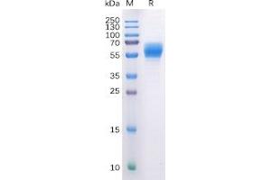 Human CB1 Protein, hFc Tag on SDS-PAGE under reducing condition. (CNR1 Protein (Fc Tag))