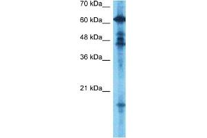Host:  Rabbit  Target Name:  GCYB1  Sample Type:  Fetal Brain lysates  Antibody Dilution:  0. (GUCY1B3 antibody  (N-Term))