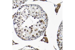 Immunohistochemistry (IHC) image for anti-Small Nuclear Ribonucleoprotein Polypeptide F (SNRPF) (AA 1-86) antibody (ABIN6148228)
