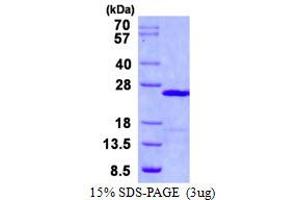 Image no. 1 for Ubiquitin-Conjugating Enzyme E2E 1 (UBE2E1) protein (His tag) (ABIN1098380)