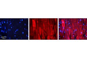 Rabbit Anti-HSPB1 Antibody Catalog Number: ARP30177_T100 Formalin Fixed Paraffin Embedded Tissue: Human Heart Muscle Tissue Observed Staining: Cytoplasm Primary Antibody Concentration: 1:100 Other Working Concentrations: 1:600 Secondary Antibody: Donkey anti-Rabbit-Cy3 Secondary Antibody Concentration: 1:200 Magnification: 20X Exposure Time: 0.