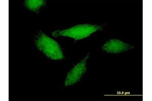 Immunofluorescence of purified MaxPab antibody to ANXA11 on HeLa cell. (Annexin A11 antibody  (AA 1-505))