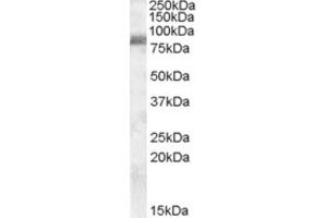 Western Blotting (WB) image for anti-Zinc Finger, RAN-Binding Domain Containing 1 (ZRANB1) (C-Term) antibody (ABIN2466754)