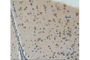 IHC-P analysis of brain tissue, with DAB staining. (CYP26A1 antibody  (AA 250-495))