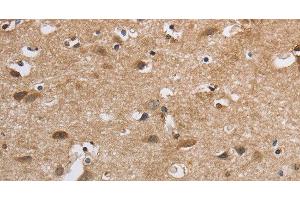 Immunohistochemistry of paraffin-embedded Human brain using SDCCAG3 Polyclonal Antibody at dilution of 1:30