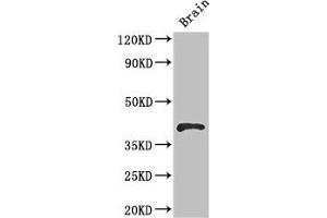 Western Blot Positive WB detected in: Mouse brain tissue All lanes: RBM4 antibody at 2. (RBM4 antibody  (AA 121-205))