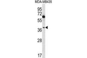 Western blot analysis in MDA-MB435 cell line lysates (35ug/lane) using NFKBIL1  Antibody  (C-term). (NFKBIL1 antibody  (C-Term))