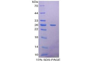SDS-PAGE analysis of Rat Pentraxin 3 Protein.