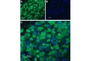 Expression of Serotonin receptor 3B in rat DRG - Immunohistochemical staining of rat dorsal root ganglion (DRG) frozen sections using Anti-5HT3B Receptor (HTR3B) (extracellular) Antibody (ABIN7043622 and ABIN7045285), followed by goat anti-rabbit-AlexaFluor-488 secondary antibody. (Serotonin Receptor 3B antibody  (Extracellular, N-Term))