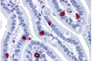 Human Small Intestine: Formalin-Fixed, Paraffin-Embedded (FFPE) (GCC2 antibody  (AA 1174-1185))