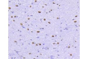Paraformaldehyde-fixed, paraffin embedded rat spinal cord, Antigen retrieval by boiling in sodium citrate buffer (pH6) for 15min, Block endogenous peroxidase by 3% hydrogen peroxide for 30 minutes, Blocking buffer at 37°C for 20min, Antibody incubation with HDAC2 (3B7) Monoclonal Antibody  at 1:50 overnight at 4°C, followed by a conjugated secondary and DAB staining.