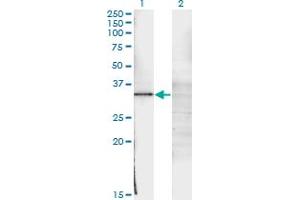 Western Blot analysis of WT1 expression in transfected 293T cell line by WT1 monoclonal antibody (M02), clone 3B12. (WT1 antibody  (AA 349-439))