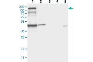 Western blot analysis of Lane 1: RT-4, Lane 2: U-251 MG, Lane 3: Human Plasma, Lane 4: Liver, Lane 5: Tonsil with PLEKHA5 polyclonal antibody .