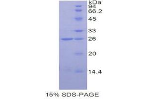 SDS-PAGE (SDS) image for Catechol-O-Methyltransferase (COMT) (AA 52-271) protein (His tag) (ABIN2120751) (COMT Protein (AA 52-271) (His tag))