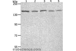 Western blot analysis of 293T, Hela, K562, NIH/3T3 and RAW264. (RAD50 antibody)