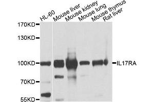 Western blot analysis of extracts of various cells, using IL17RA antibody. (IL17RA antibody)