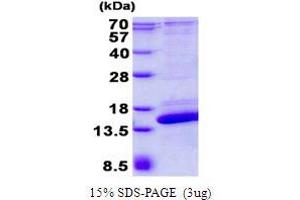 SH3 Domain Binding Glutamic Acid-Rich Protein Like 2 (SH3BGRL2) protein (His tag)
