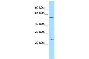 Host:  Rabbit  Target Name:  Ankrd13c  Sample Type:  Mouse Testis lysates  Antibody Dilution:  1. (ANKRD13C antibody  (C-Term))
