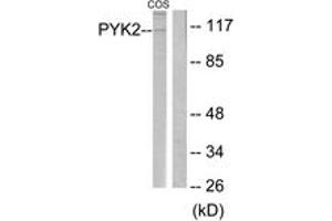 Western Blotting (WB) image for anti-PTK2B Protein tyrosine Kinase 2 beta (PTK2B) (AA 546-595) antibody (ABIN2888606) (PTK2B antibody  (AA 546-595))