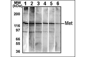 Detection of endogenous Met in HepG2 cell line. (c-MET antibody  (Catalytic Domain))
