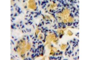 Used in DAB staining on fromalin fixed paraffin-embedded Bowels tissue (PKC zeta antibody  (AA 404-591))
