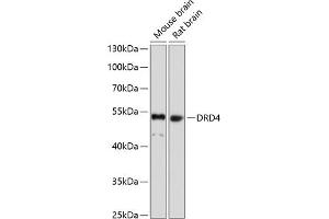 Western blot analysis of extracts of various cell lines, using DRD4 antibody (ABIN1679595, ABIN5663875, ABIN5663877 and ABIN6217338) at 1:1000 dilution. (DRD4 antibody  (AA 100-200))